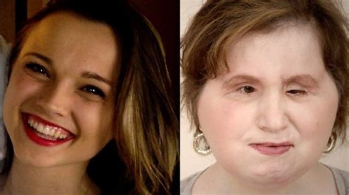 
Katie Stubblefield Before and After Accident: Why Did She Shot Herself? 